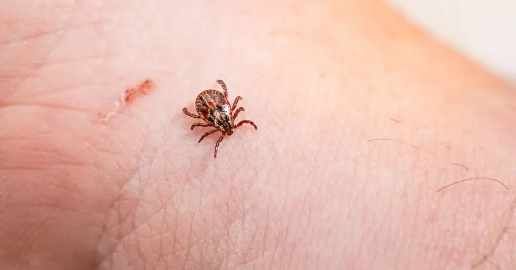 tick bites surge