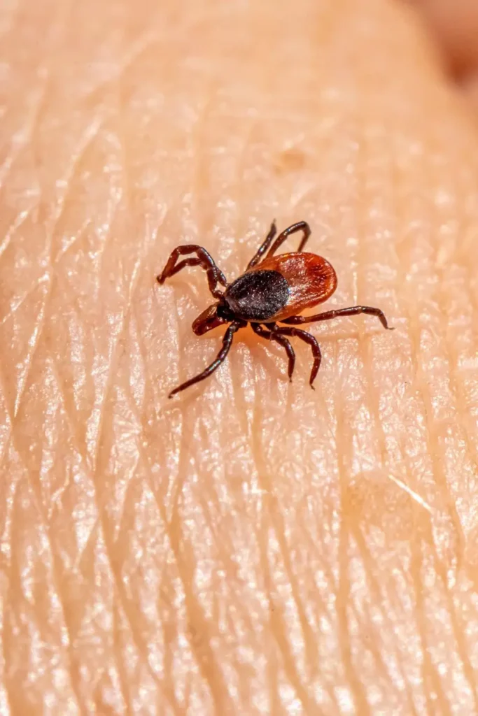 tick bites surge